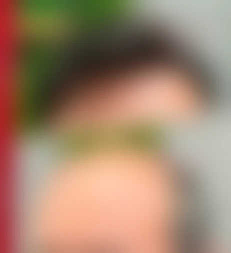 Resultado de prótese capilar da Barbearia Verdugo