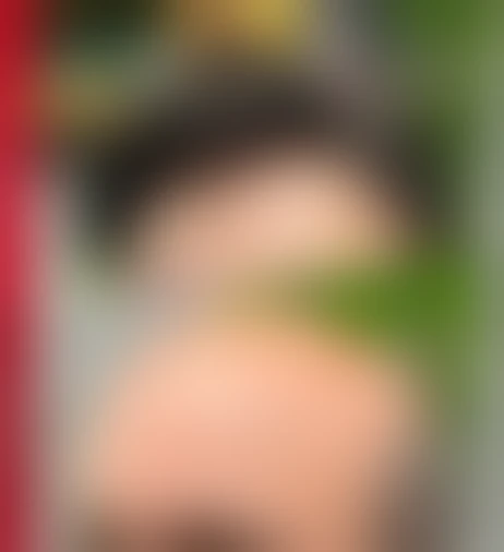 Resultado de prótese capilar Verdugo