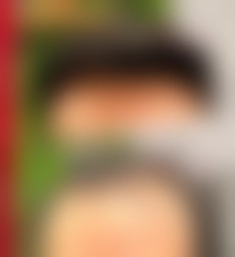 Resultado de prótese capilar Verdugo