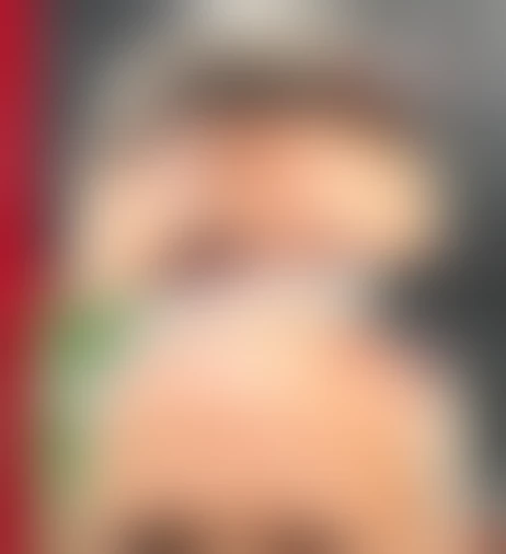 Resultado de prótese capilar Verdugo